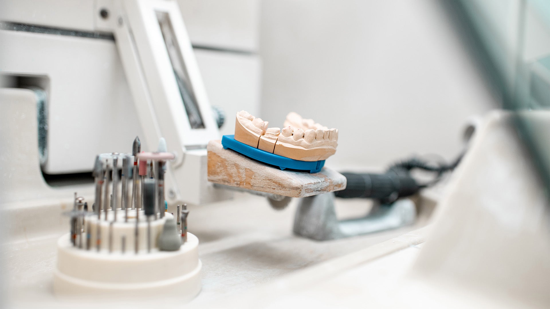 Why Dentists are Bringing Labs In-House
