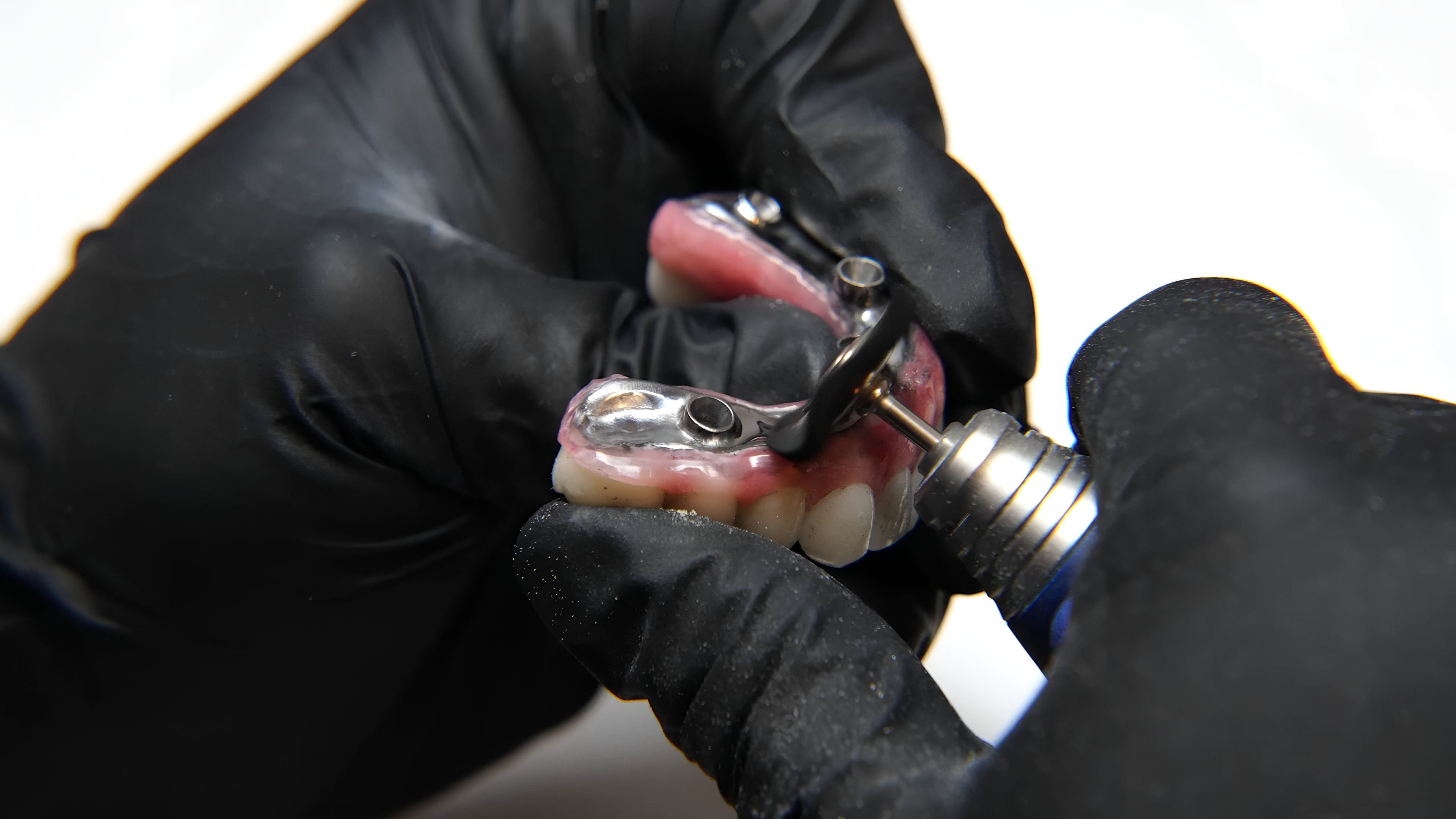 Dental Polishing Equipment That Delivers a Flawless Finish