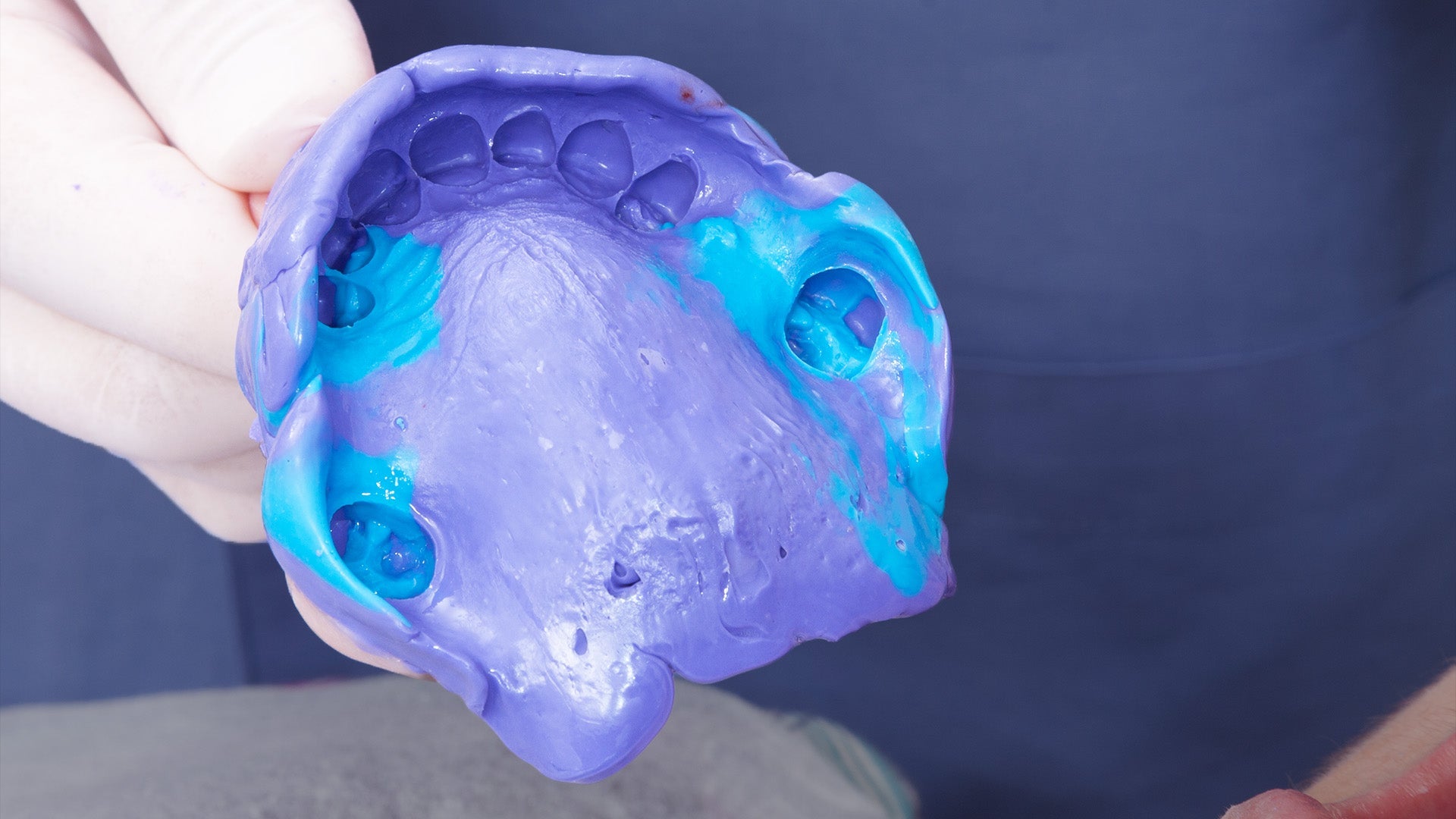 Why the Right Dental Polymer is a Game-Changer for Your Lab